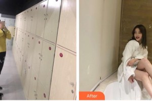 上海時(shí)光整形外科醫(yī)院張晶整形價(jià)格表附吸脂瘦腰腹案例展示