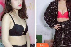 貴州整形美容外科醫(yī)院魯天宇整形價(jià)格表附隆胸案例展示