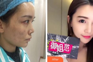 宜昌第二人民醫(yī)院醫(yī)學(xué)美容科徐漢珍整形價(jià)格表附激光美膚祛斑案例展示