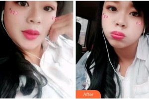 宜昌第二人民醫(yī)院醫(yī)學(xué)美容科朱遠(yuǎn)平整形價(jià)格表附　　昨天充滿勇氣地去嘗試了冷光美白牙齒，今天就來和大家分享一下～ 調(diào)節(jié)開始前醫(yī)生先找出了我牙齒原來的色號(hào)，并且會(huì)告知做完之后大概會(huì)白到哪個(gè)色號(hào)。我之