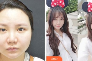 合肥劉大夫美容整形醫(yī)院金問正整形價(jià)格表附面部輪廓案例展示