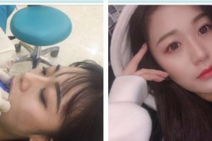 上海市口腔醫(yī)院包向軍整形價格表附全隱形牙齒矯正案例展示