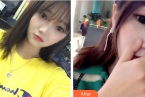 上海拜博昌仁口腔門診部魏兵整形價(jià)格表附超聲波潔牙案例展示