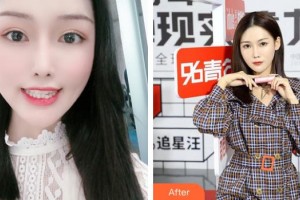 上海雅圣口腔門診部劉玉春整形價(jià)格表附隱形矯正案例展示