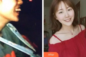 上海華美醫(yī)療美容醫(yī)院姚廣楠整形價(jià)格表附隱形托槽矯正案例展示