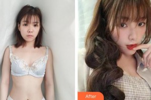 上海愛爾麗醫(yī)療美容門診部李鐵國整形價格表附濃縮豐胸真實(shí)案例展示