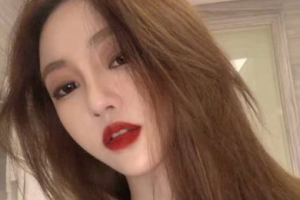 北京今典花園永康口腔門診部李曉燕整形價(jià)格表附金屬托槽矯正案例展示