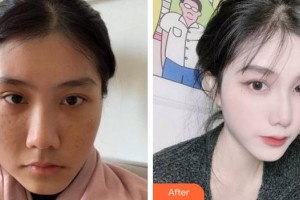 上海安平醫(yī)院美容科曾海波整形價格表附美白嫩膚案例展示