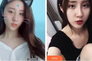 上海柏薈醫(yī)療美容門診部王昭欽整形價格表附激光美膚激光祛斑案例展示