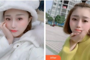 上海維樂口腔門診部邱夢珍整形價格表附牙齒金屬矯正案例展示