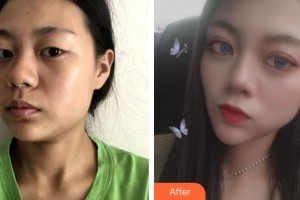 上海維樂口腔門診部柯良騏整形價格表附下頜角整形案例展示