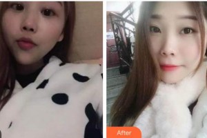 上海匯尚口腔門診部莊龍飛整形價格表附自鎖托槽矯正案例展示