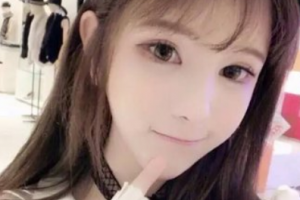 江西新視界眼科醫(yī)院周新洪整形價(jià)格表附切開雙眼皮案例展示