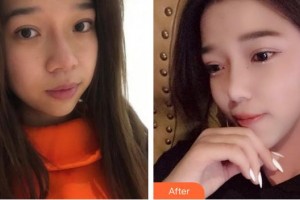 成都艾尚醫(yī)學(xué)美容門診部嚴(yán)新整形價格表附祛斑案例展示