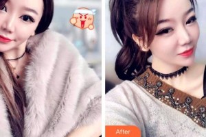 成都伊莎貝拉醫(yī)療美容門診部金鐘淵整形價格表附牙齒矯正案例展示