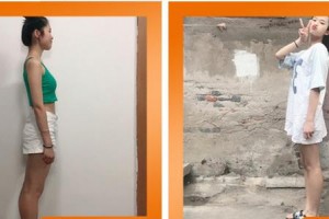 成都百齡駐顏醫(yī)學(xué)美容門診部肖宛平整形價格表附美體塑形案例展示