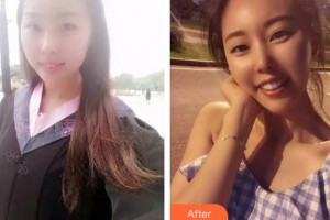 成都藝星醫(yī)療美容醫(yī)院辛定基整形價格表附陶瓷矯正牙齒案例展示