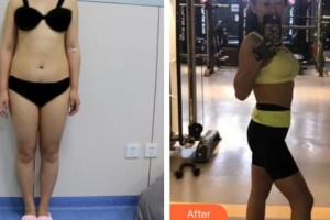 成都華顏醫(yī)療美容門診部姜楠整形價格表附美體塑形案例展示