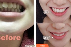 成都華顏醫(yī)療美容門診部王少安整形價(jià)格表附牙綜合案例展示