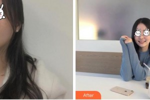 成都華顏醫(yī)療美容門診部何璇整形價(jià)格表附紅寶石祛斑案例展示