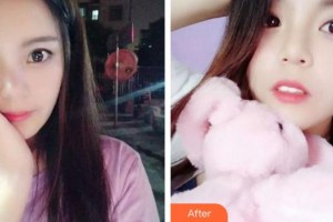 成都華顏醫(yī)療美容門診部黃俊整形價(jià)格表附牙綜合案例展示