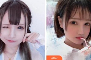 成都雍禾植發(fā)醫(yī)院李丙雙整形價(jià)格表附種植發(fā)際線案例展示