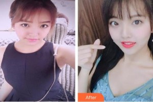 成都華顏醫(yī)療美容門診部金鐘都整形價(jià)格表附胸部整形案例展示