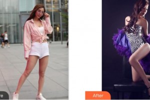 成都圣形醫(yī)療美容診所周建林整形價格表附大腿吸脂案例展示