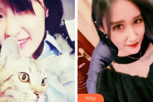 成都赫拉醫(yī)療美容整形醫(yī)院陽子整形價格表附眼部綜合案例展示