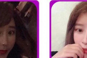 成都悅麗美科李德敏整形價格表附埋線提升案例展示