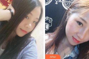 成都科思研醫(yī)療美容診所代維整形價格表附鼻部整形案例展示