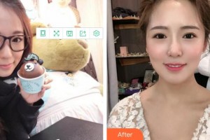 成都市中西醫(yī)結(jié)合醫(yī)院醫(yī)療美容科鄧宇恬整形價格表附牙綜合案例展示