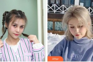 成都瑞麗詩美學(xué)植發(fā)門診部尚俊整形價格表附發(fā)際線案例展示