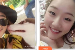 成都華廈眼科醫(yī)院張學(xué)進整形價格表附牙齒矯正案例展示