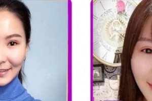 成都茁悅口腔診所劉恒整形價格表附牙齒隱形矯正案例展示