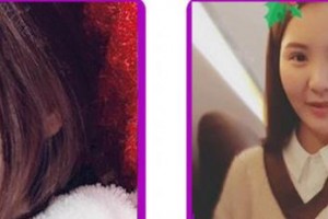 成都康橋眼科醫(yī)院蔡小玲整形價格表附牙齒隱形矯正案例展示