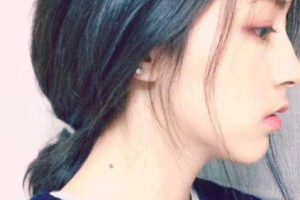 天津紫潔醫(yī)療美容門診部王椿燕整形價格表附激光祛斑案例展示