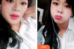 成都亞非牙科醫(yī)院李顯軍整形價(jià)格表附冷光美白案例展示