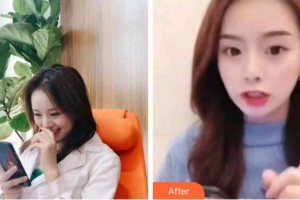 成都華西牙種植醫(yī)院易新竹整形價(jià)格表附超聲波潔牙案例展示