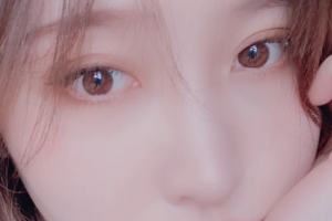 西安女子醫(yī)院醫(yī)學(xué)美容科張國(guó)孝整形價(jià)格表附面部吸脂案例展示