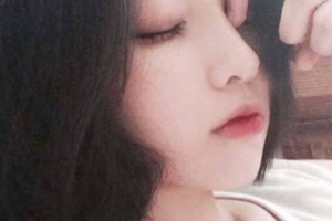 西安艾薇美醫(yī)療美容門(mén)診部王冀耕整形價(jià)格表附膨體墊下巴案例展示