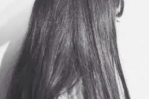 西安高一生醫(yī)療美容醫(yī)院和娟整形價格表附顴骨顴弓整形術(shù)案例展示