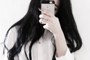 西安女子醫(yī)院醫(yī)學美容科楊建征整形價格表附顴骨降低案例展示