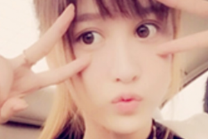 西安解放軍第323醫(yī)院整形美容科王瑞整形價格表附眼部綜合案例展示