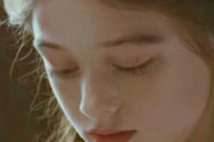 西安莎曼妃醫(yī)療美容醫(yī)院樸俊整形價格表附超聲提拉案例展示