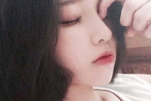 西安綠港醫(yī)療美容整形醫(yī)院張勇整形價格表附美白導入案例展示