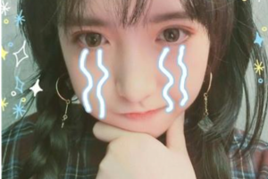 西安藝星醫(yī)療整形美容醫(yī)院宋蔚1整形價格表附玻尿酸精華導入案例展示