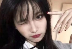 西安市第一醫(yī)院眼科韋偉整形價格表附眼部綜合案例展示