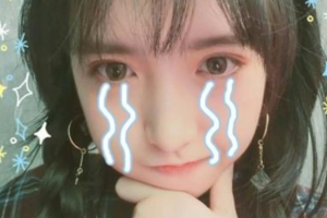 西安醫(yī)學院第二附屬醫(yī)院醫(yī)學美容中心陳杰整形價格表附眼部整形案例展示