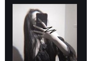 西安小白兔口腔醫(yī)院段紅紅整形價(jià)格表附金屬托槽矯正案例展示